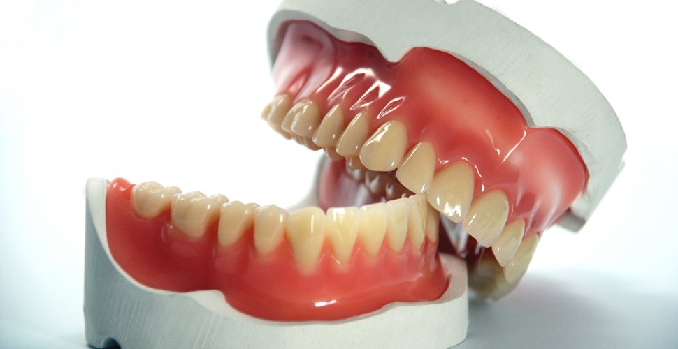 Съемные зубные протезы 