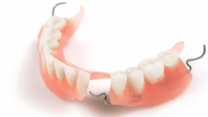 протезирование при большом количестве отсутствующих зубов