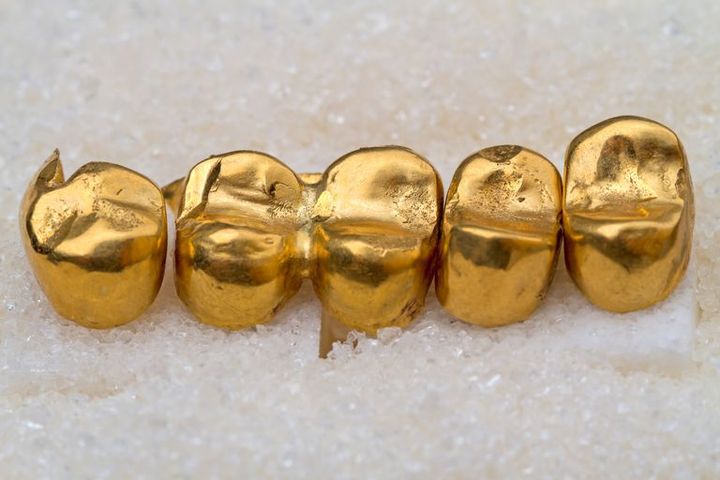 Золотые коронки Томск Стрелочный 1-й детская стоматология на ленина томск регистратура телефон